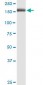 MRC1 Antibody (monoclonal) (M02)