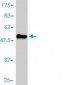 MRE11A Antibody (monoclonal) (M01)