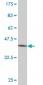 MRPS25 Antibody (monoclonal) (M01)