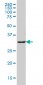 MS4A1 Antibody (monoclonal) (M01)