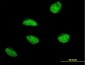 MSH5 Antibody (monoclonal) (M08)