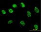 MSH6 Antibody (monoclonal) (M01)