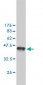 MSH6 Antibody (monoclonal) (M01)