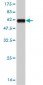 MSI2 Antibody (monoclonal) (M08)