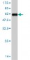 MSI2 Antibody (monoclonal) (M08)