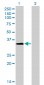 MSI2 Antibody (monoclonal) (M08)