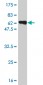 MSI2 Antibody (monoclonal) (M13)