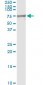 MSLN Antibody (monoclonal) (M02)