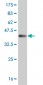 MSLN Antibody (monoclonal) (M02)