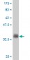MSMB Antibody (monoclonal) (M08)