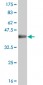 MTA1 Antibody (monoclonal) (M01)