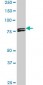 MTA1 Antibody (monoclonal) (M01)