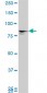 MTA1 Antibody (monoclonal) (M01)