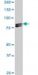 MTA1 Antibody (monoclonal) (M01)