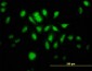 MTA1 Antibody (monoclonal) (M02)