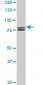 MTA1 Antibody (monoclonal) (M02)