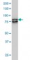 MTA1 Antibody (monoclonal) (M02)