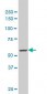 MTA1 Antibody (monoclonal) (M02)