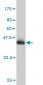 MTAP Antibody (monoclonal) (M01)