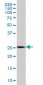 MTHFS Antibody (monoclonal) (M01)