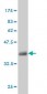 MUC5AC Antibody (monoclonal) (M07)