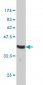 MUTYH Antibody (monoclonal) (M01)