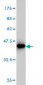 MVD Antibody (monoclonal) (M01)