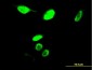 MYBL2 Antibody (monoclonal) (M03)