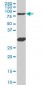 MYBL2 Antibody (monoclonal) (M03)