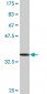 MYL6 Antibody (monoclonal) (M03)