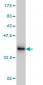 NADSYN1 Antibody (monoclonal) (M01)