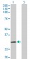 NAT2 Antibody (monoclonal) (M01)