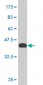 NCOA4 Antibody (monoclonal) (M04)