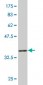 NDOR1 Antibody (monoclonal) (M01)