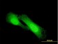 NDRG1 Antibody (monoclonal) (M03)