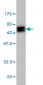NDRG1 Antibody (monoclonal) (M03)