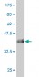 NDRG2 Antibody (monoclonal) (M03)