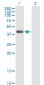 NDRG2 Antibody (monoclonal) (M03)