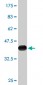 NDRG2 Antibody (monoclonal) (M06)