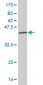 NDUFAB1 Antibody (monoclonal) (M06)