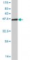 NDUFB11 Antibody (monoclonal) (M08)