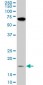 NDUFB11 Antibody (monoclonal) (M08)