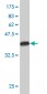 NDUFB7 Antibody (monoclonal) (M01)