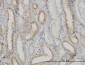 NDUFS3 Antibody (monoclonal) (M02)