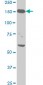 NEFH Antibody (monoclonal) (M01)