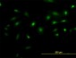 NEK2 Antibody (monoclonal) (M02)