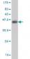 NEK2 Antibody (monoclonal) (M11)