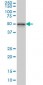 NEK2 Antibody (monoclonal) (M11)