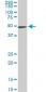 NEK2 Antibody (monoclonal) (M11)