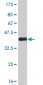 NEK9 Antibody (monoclonal) (M01)
